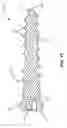 Fig. 09 - Implant with an interference fit fastener