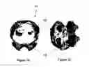Fig. 02 - MODELING MICRO-SCAFFOLD-BASED IMPLANTS FOR BONE TISSUE ENGINEERING
