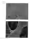 Fig. 06 - Article with foamed surface, implant and method of producing the same