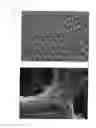 Fig. 09 - Article with foamed surface, implant and method of producing the same