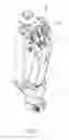 Fig. 02 - Cushion structure of artificial knee joint