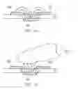 Fig. 09 - Capacitive position sensor