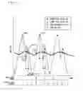 Fig. 15 - BODY MOVEMENT MEASURING DEVICE, MOBILE PHONE, METHOD FOR CONTROLLING THE BODY MOVEMENT MEASURING DEVICE, BODY MOVEMENT MEASURING DEVICE CONTROL PROGRAM, AND COMPUTER-READABLE RECORDING MEDIUM IN WHICH THE BODY MOVEMENT MEASURING DEVICE CONTROL PROGRAM IS RECORDED