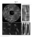 Fig. 07 - Method and system for modeling bone structure from collagen bundle orientations