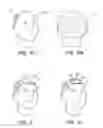 Fig. 09 - Follicular unit transplantation planner and methods of its use