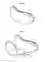 Fig. 04 - Goggle lens interchange system