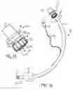 Fig. 02 - Connector for coupling a tracheal tube to an auxiliary device