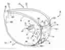 Fig. 01 - Female condom