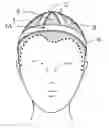 Fig. 01 - Hair Integration Assembly
