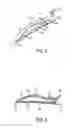Fig. 05 - Hair clip