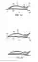 Fig. 06 - Hair clip