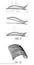Fig. 09 - Hair clip
