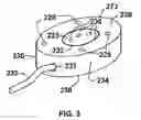 Fig. 04 - Material removal systems and methods utilizing foam