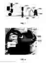 Fig. 08 - Material removal systems and methods utilizing foam
