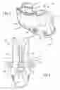 Fig. 02 - Bath spout cover
