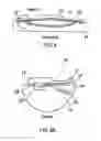 Fig. 07 - Semi-rigid tool having sections that vary from one another in rigidity
