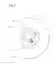 Fig. 05 - NO FILTER NO RUN FLUID FILTRATION SYSTEM