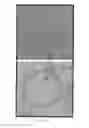 Fig. 16 - Micropores and methods of making and using thereof