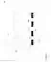 Fig. 10 - Method and apparatus for generating phosphor film with textured surface