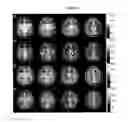 Fig. 06 - METHOD FOR RADIOFREQUENCY MAPPING IN MAGNETIC RESONANCE IMAGING