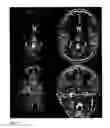 Fig. 07 - METHOD FOR RADIOFREQUENCY MAPPING IN MAGNETIC RESONANCE IMAGING