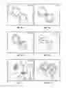 Fig. 06 - 3D Biplane Microscopy