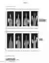 Fig. 14 - Method and apparatus of identifying human body posture