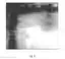 Fig. 09 - Wafer imaging and processing method and apparatus