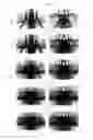 Fig. 06 - Luminance enhancement optical substrates with anti-interference-fringe structures