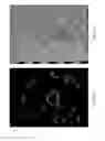 Fig. 07 - Automatic extraction of planetary image features