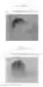 Fig. 08 - Method for formation of reagent layer in analysis apparatus, method for manufacture of anlalysis apparatus, and analysis apparatus