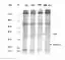 Fig. 01 - PROTEASE INHIBITOR