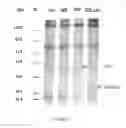 Fig. 22 - PROTEASE INHIBITOR