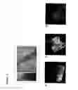Fig. 04 - SKIN EQUIVALENT CULTURE