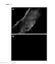 Fig. 11 - SKIN EQUIVALENT CULTURE