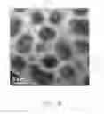 Fig. 09 - Method for preparing transmission electron microscope sample
