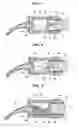 Fig. 02 - Capsule for tooth restorative material