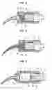 Fig. 03 - Capsule for tooth restorative material