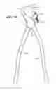 Fig. 07 - DENTAL PLIERS WITH ADJUSTABLE BUMPER