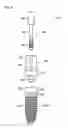 Fig. 07 - Medical device and method for producing the same