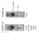 Fig. 02 - Methods and kits for separation and detection of proteins in biological samples