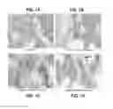 Fig. 02 - Methods and Compositions for Treating Neurological Disease