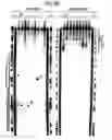 Fig. 09 - RNA interference mediating small RNA molecules
