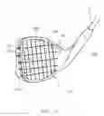 Fig. 03 - Soft golf club head