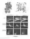 Fig. 06 - DETECTION OF MUTATIONS IN ACTA2 AND MYH11 FOR ASSESSING RISK OF VASCULAR DISEASE