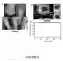Fig. 09 - DETECTION OF MUTATIONS IN ACTA2 AND MYH11 FOR ASSESSING RISK OF VASCULAR DISEASE
