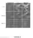 Fig. 11 - DETECTION OF MUTATIONS IN ACTA2 AND MYH11 FOR ASSESSING RISK OF VASCULAR DISEASE