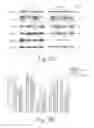 Fig. 06 - Endothelial monocyte activation polypeptide II, a biomarker for use in diagnosis and treatment of brain injury