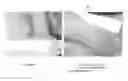 Fig. 01 - Wound Healing