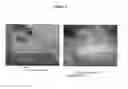 Fig. 04 - Wound Healing